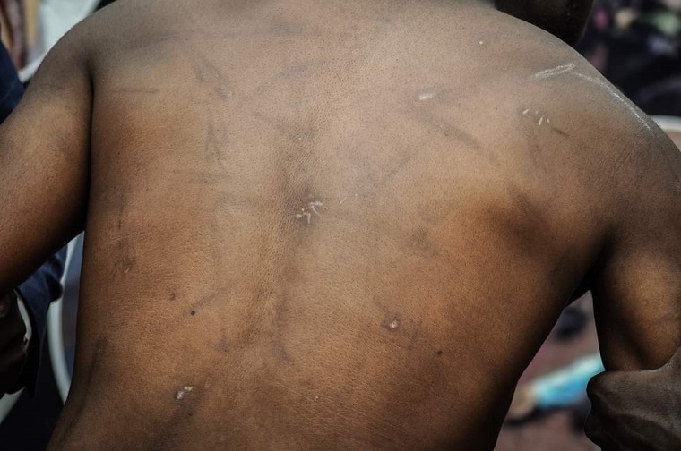 CMI-torture victim awarded Shs 172m